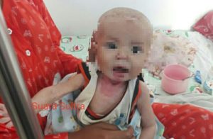 Bayi Tujuh Bulan Menderita Gizi Buruk