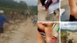 Warga Desa Motaha dan Lamoen Jadi Korban Pembacokan Diduga oleh Karyawan PT Marketindo Selaras di Konsel