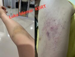 Direktur PT AMBO Resmi Tersangka KDRT, Kuasa Hukum Korban Sebut Penggerebekan Karaoke Hanya Skenario