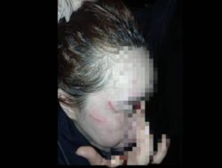Perempuan di Butur Diduga Dianiaya Istri Siri Oknum Polisi, Korban Diadang Saat Hendak Melapor
