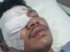 Diduga Dikeroyok dan Dibacok Geng Bersenjata Tajam di Bau-Bau, Azmar Kehilangan Penglihatan Permanen
